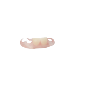 Flexible Valplast‑Style Partial Denture