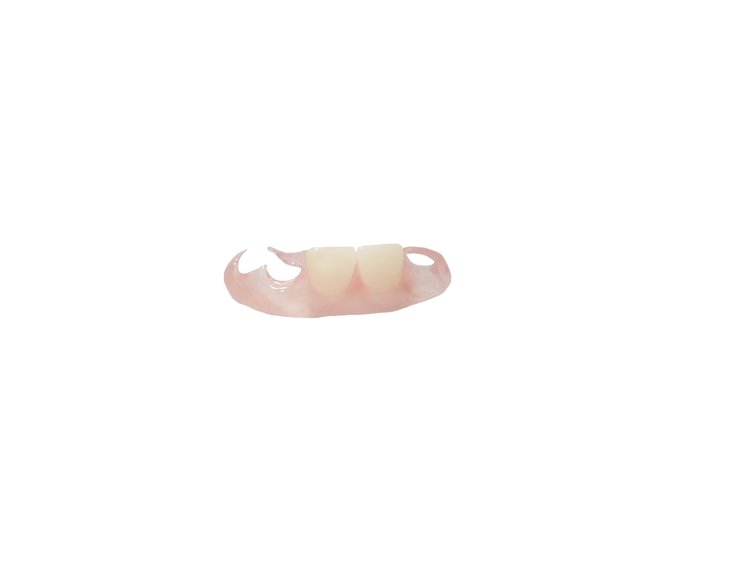 Flexible Valplast‑Style Partial Denture