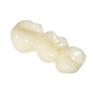 Full Zirconia Crowns & Bridges