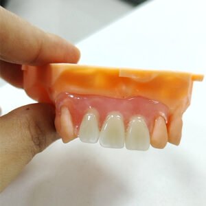 Flexible Valplast‑Style Partial Denture
