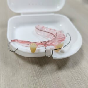 Hawley Retainer with Pontic