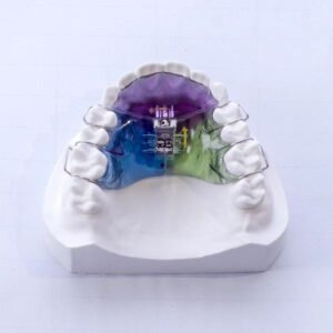 Dental Palatal Expander
