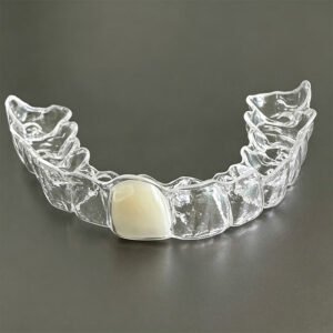 Clear Retainer with Pontic